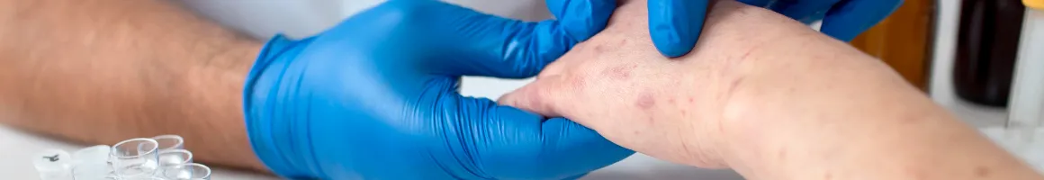 Allergy Testing & Management