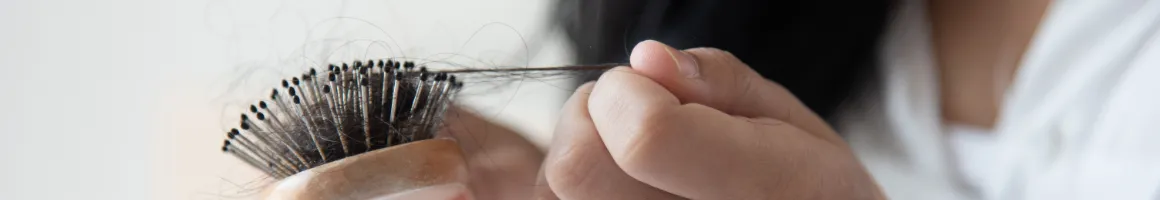 Hair Loss Treatment
